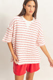 Oversized Striped Top