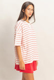 Oversized Striped Top